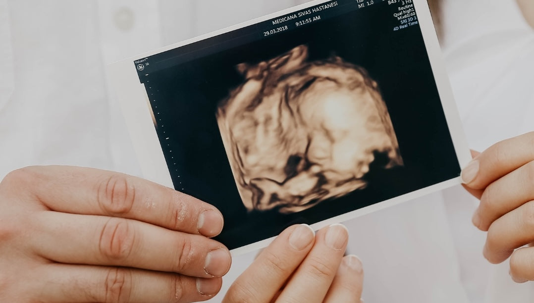 How to Announce Pregnancy: Unique and Creative Ideas for Your Special Moment